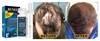 castor hair growth