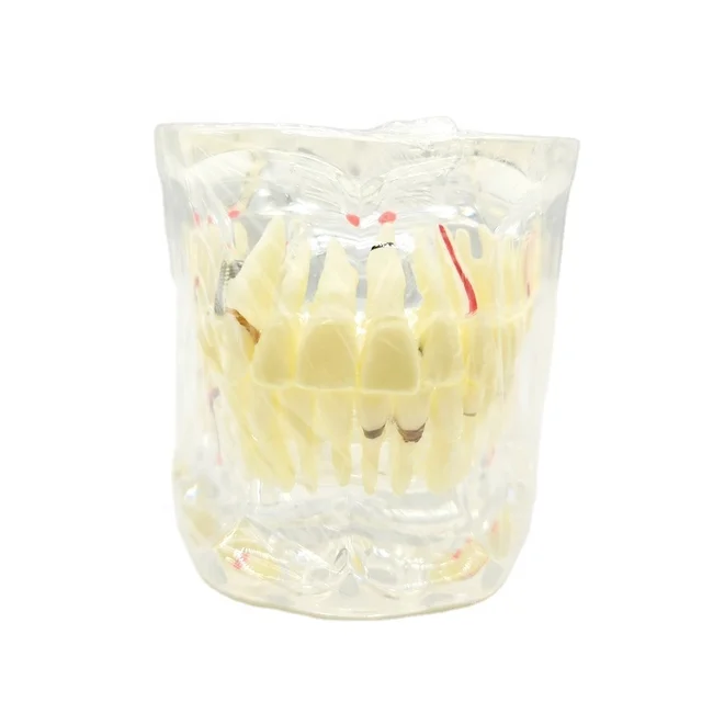 High Quality Dental Tooth Model M4001-1 Adult Model With Pathologies