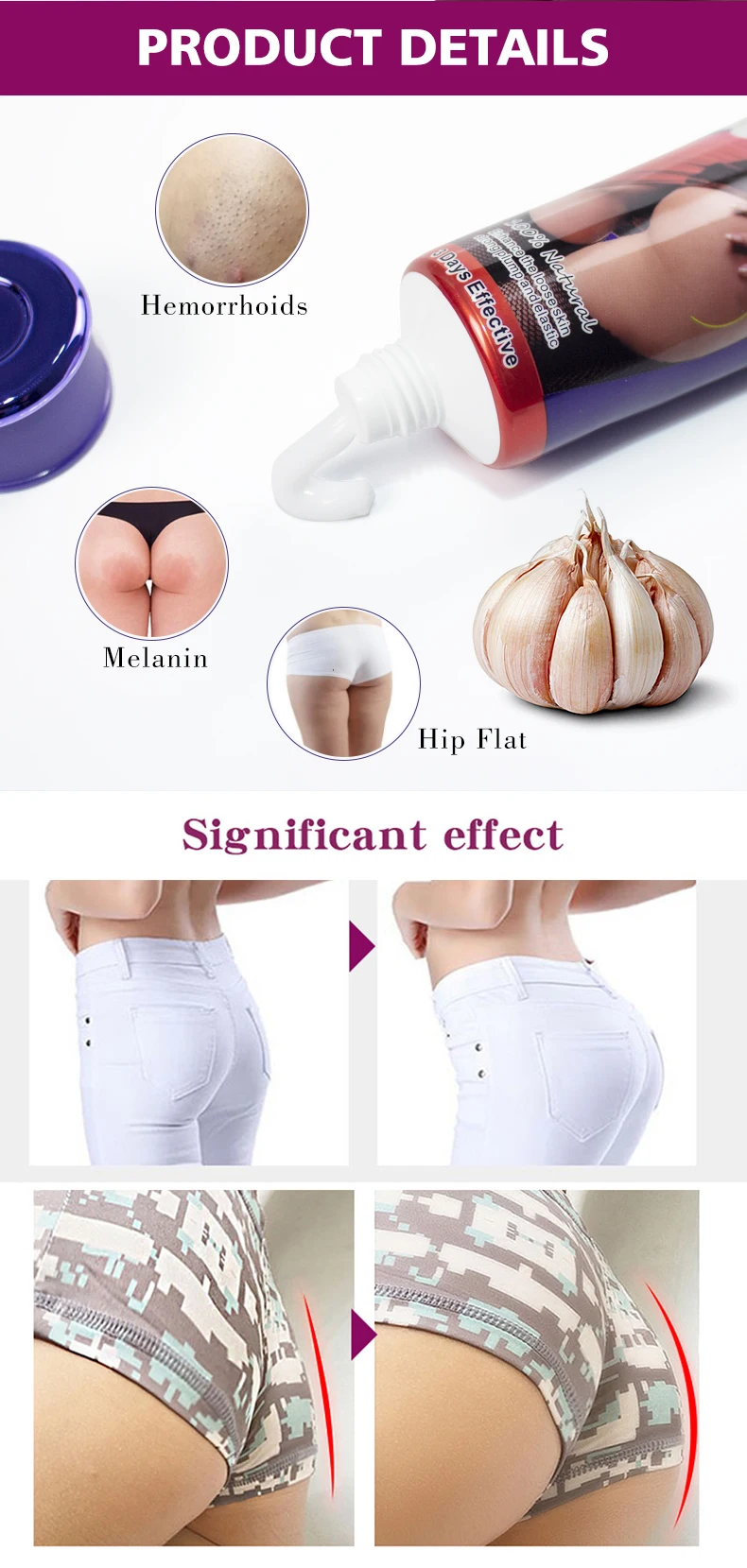 Aichun Beauty Carlic Hip up Enlargement Lifting 3 Days Fast Butt Firming Cream