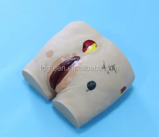 Advanced Stage Decubitus Sore Training Model For Nursing Practice - 4 Stage Pressure Ulcer Simulator