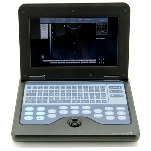 CONTEC CMS600P2VET 10.1 Inch Veterinary Ultrasound Bovine Notebook Doppler Cheap Veterinary Ultrasound Machine