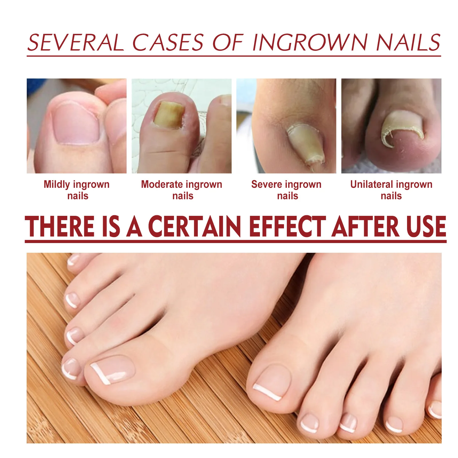 Nail Renewal Extra Strength Fungus Toe Fingernails Repair Liquid Renew Damaged Broken Nail 7 Days Nail Fungus Treatment