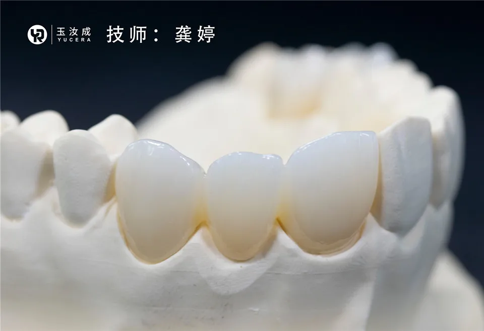 Wholesale Price Yucera SHT Multilayer Zirconia Blocks Dental Lab Zirconia Block of Denture