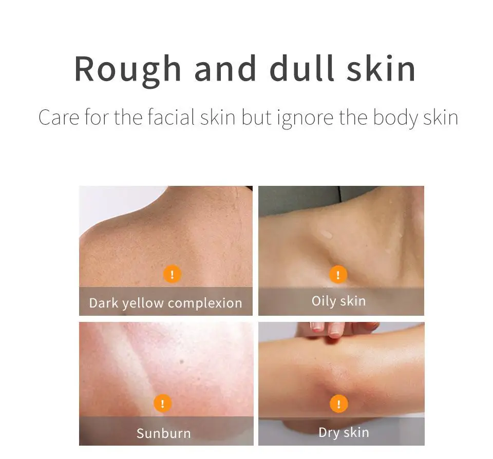 4_SKIN EVER VC300m