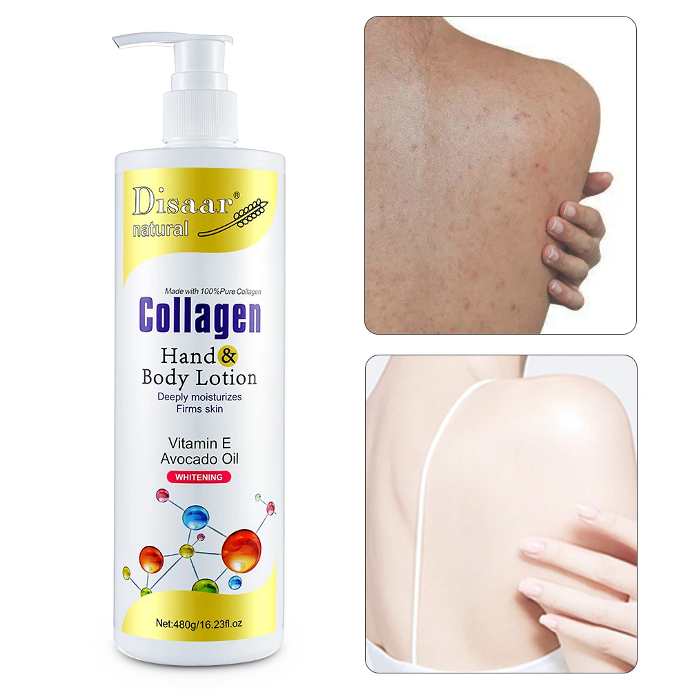 Lotion éclaircissante à l'huile d'avocat et à la vitamine E naturelle  Disaar, 100% pure, hydrate en profondeur, collagène pour la peau, femmes  adultes, approvisionnement OEM/ODM| Alibaba.com