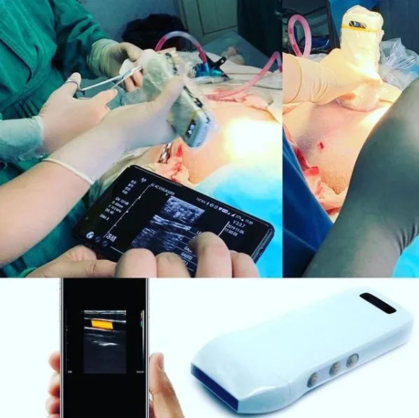 Factory Price Cardiac Sector Phased Array Probe Ultrasonic Ultrasound Linear Probe on Sale factory