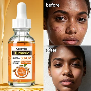 Calantha Turmeric & Nicotinamide Whitening Serum Dark Spot Eraser Brightening Skin Even Fades Blemishes Acne Face Care