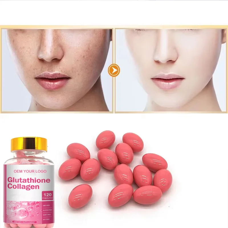 OEM 5000mg Skin CARE Capsule Glutathione Soft Gel CAPSULES Private Label  Skin Whitening Glutathione Sofe Gel Pills Capsules| Alibaba.com