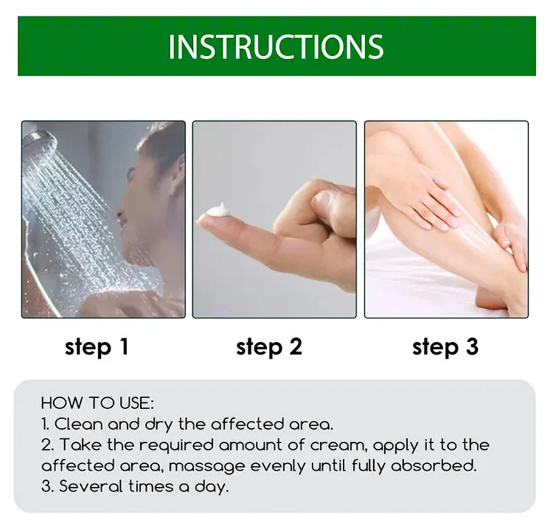 Factory Customization Chinese Herbal Dermatitis Cream Skin Eczema Itching Antipruritic Psoriasis Cream