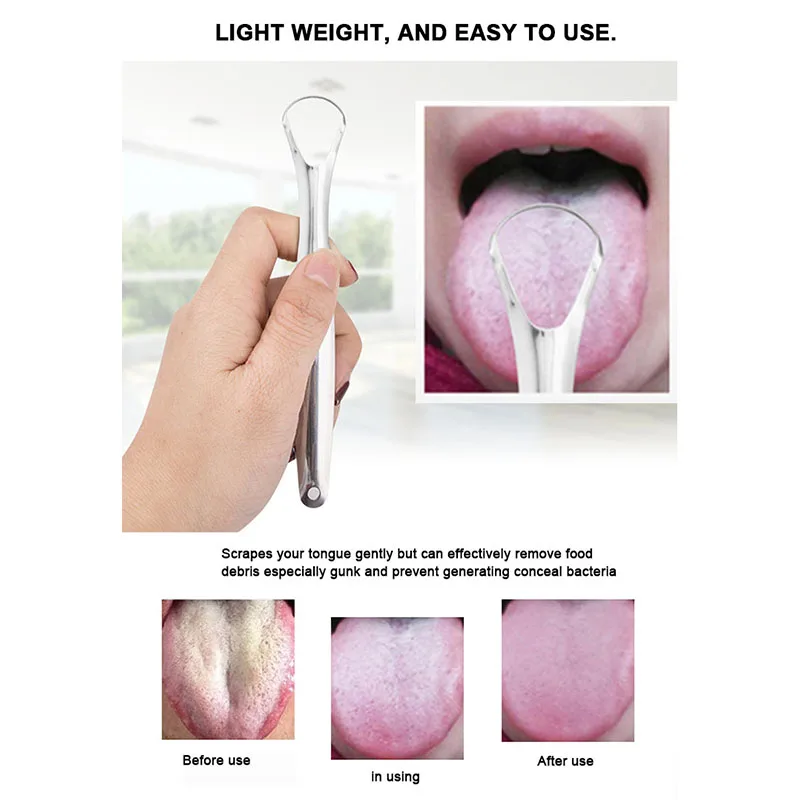 U Shape Rose Gold Tongue Scraping Private Label Case Oral Cleaner Stainless Steel Tongue Scraper With Handle