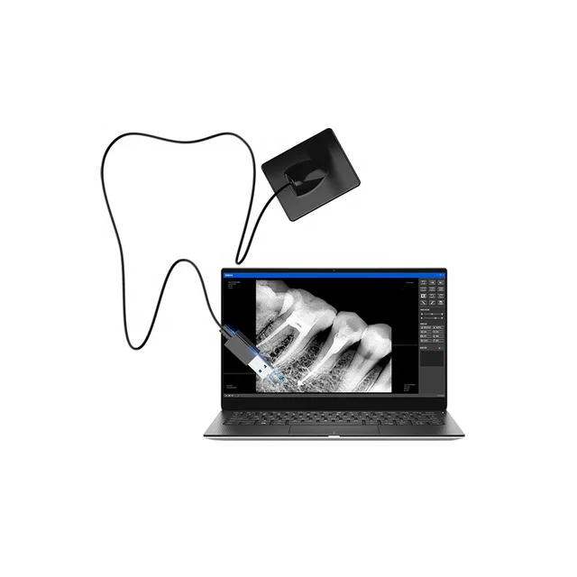 High Quality Digital x-ray Sensor RVG Dental Sensor can be Intelligent Image Processing for Dentistry Clinic Dentist