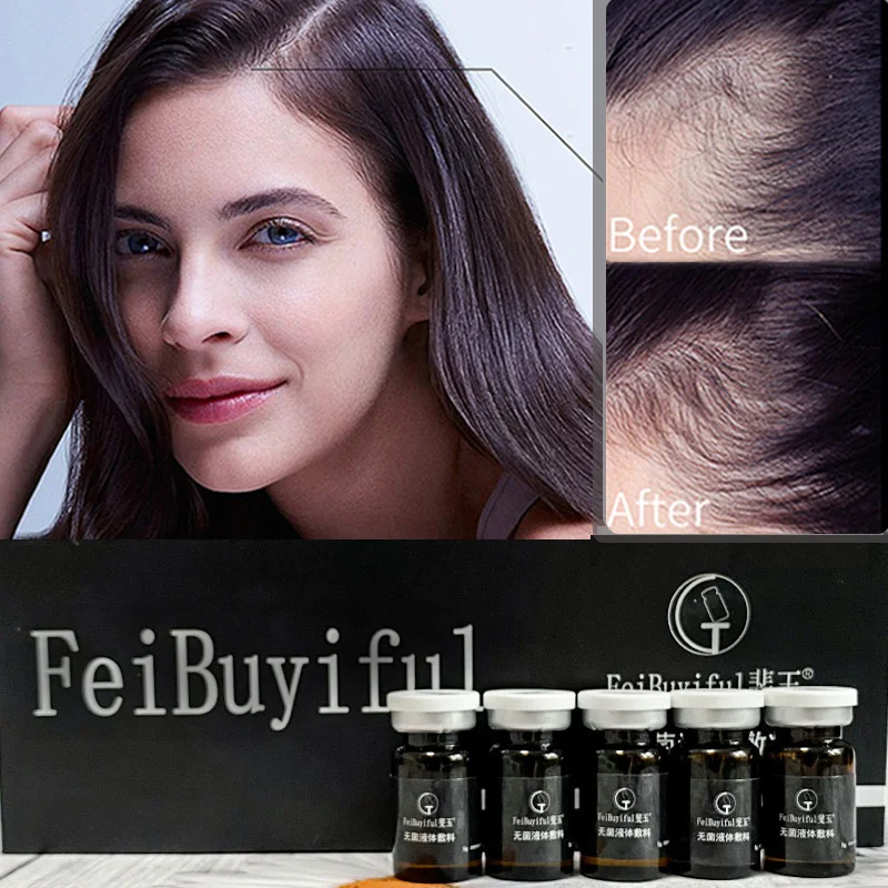 S Effective Stem Cell Hair Growth Serum - Anti Hair Loss