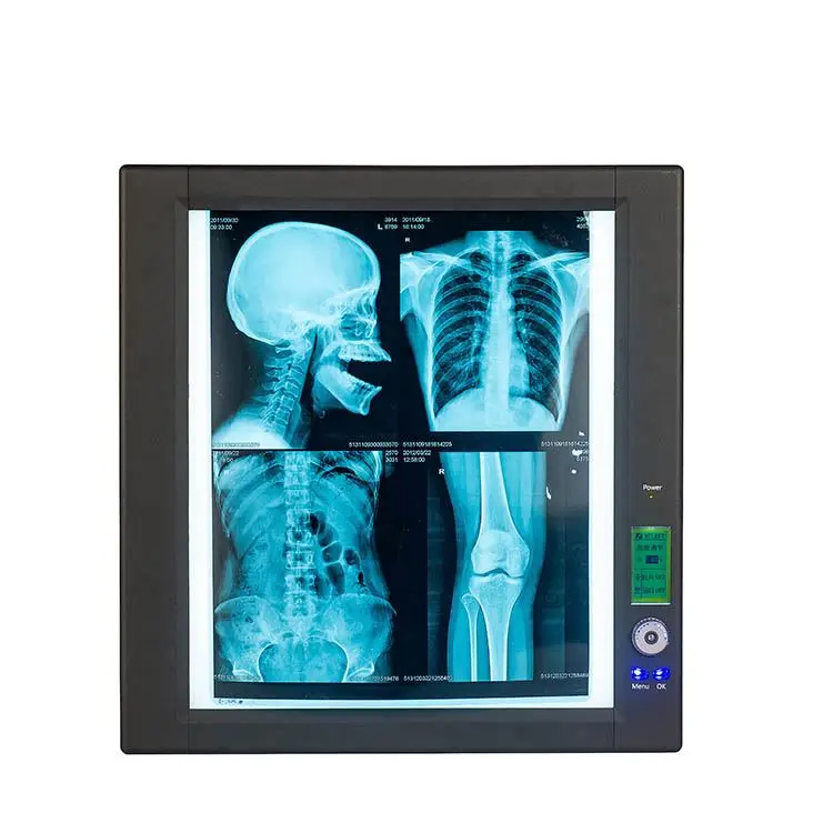 病院CTスキャン機X線フィルムビューアーLED X線撮影フィルム