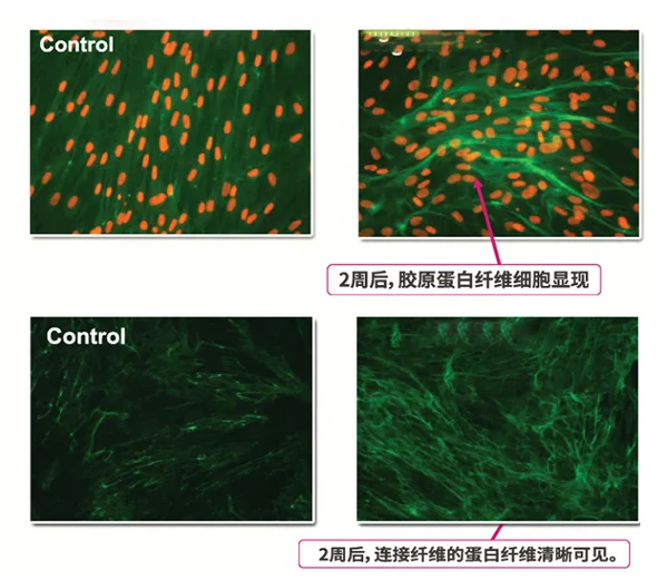 
Частной марки OEM 10 мл 15 мл 30 мл шрамы от акне ремонт глубокий Strech удаление меток сыворотка эссенция для шрамы удалить 