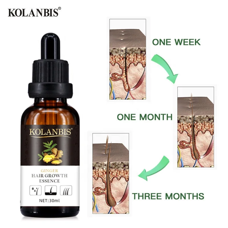 Фирменная Сыворотка для роста волос, 30 мл, индивидуальная Сыворотка для восстановления волос, Оптовая продажа, лечение выпадения волос, Тонизирующее масло OEM ODM