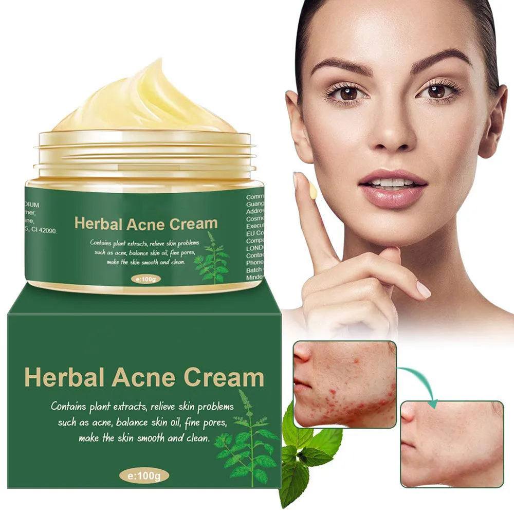 Nuonove herbal deals acne cream