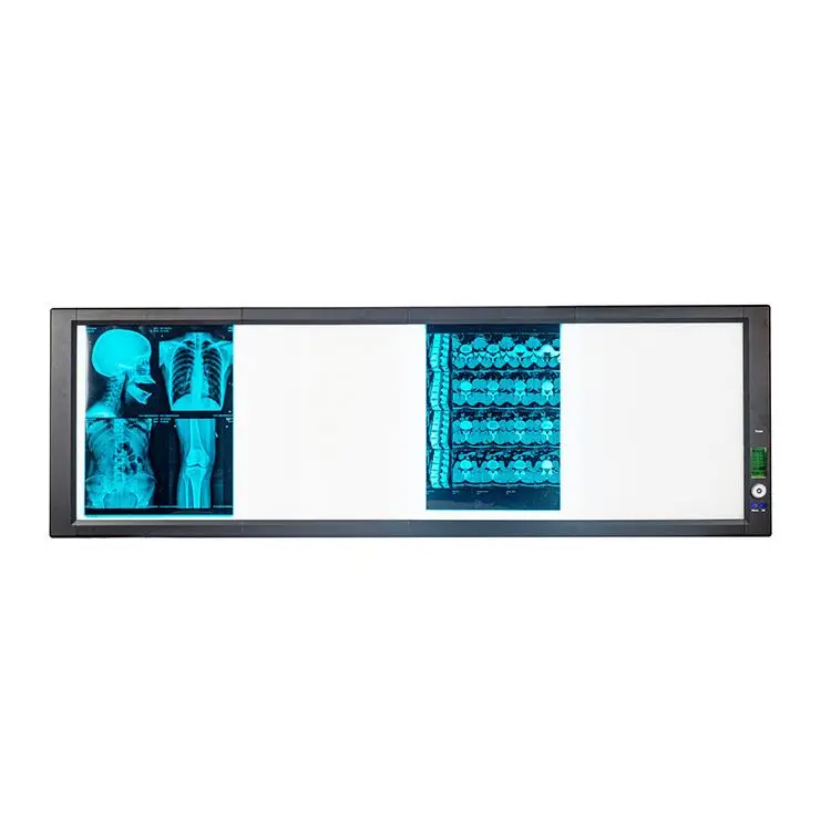 病院CTスキャン機X線フィルムビューアーLED X線撮影フィルム