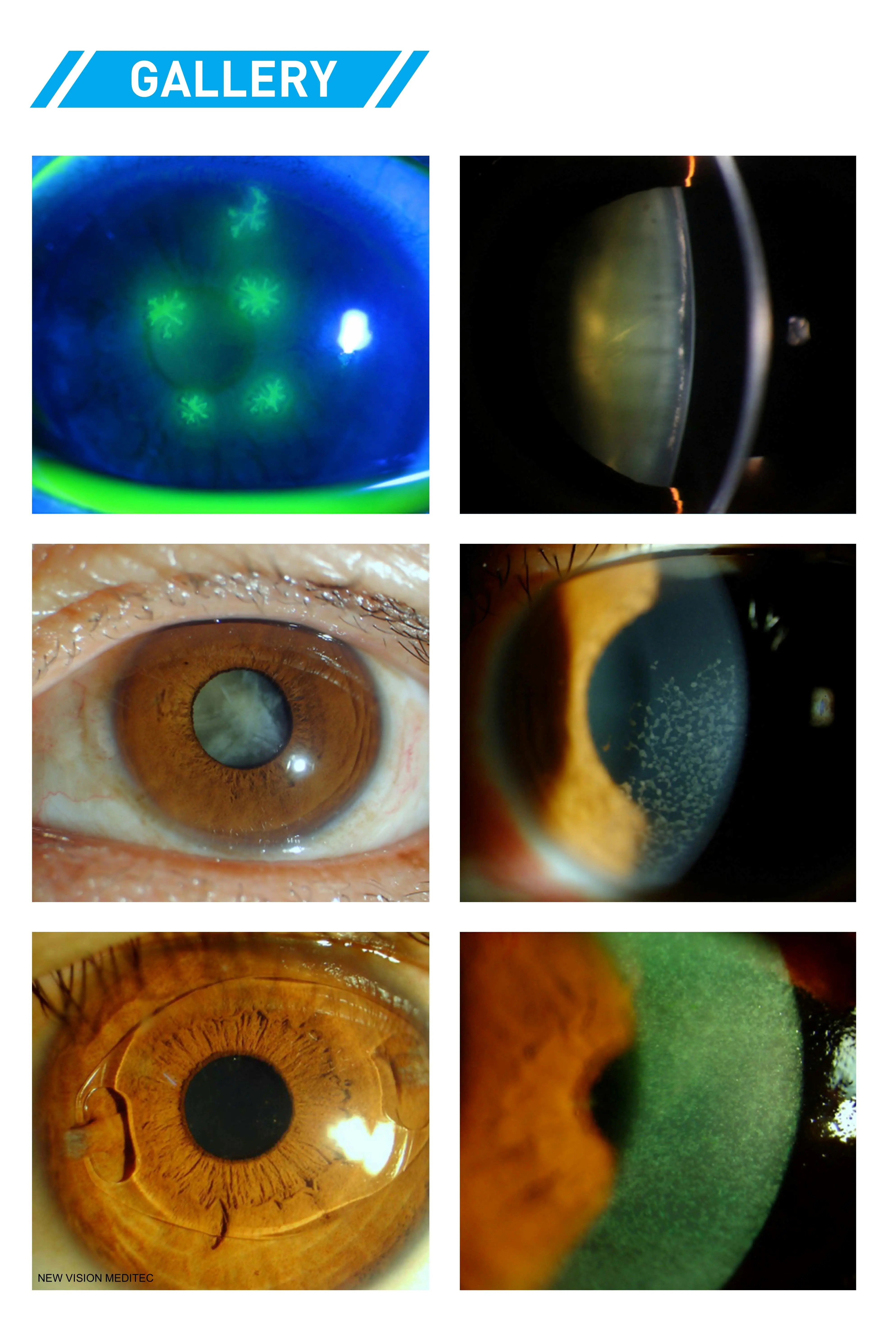 Digital Slit Lamp for LS-4 LS-5X Video Slitlamp Microscope with DLSR Camera System