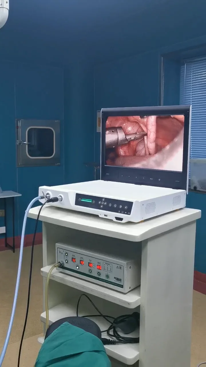 Caméra laparoscopique HD orl, système de caméra endoscopique, pièces de  rechange gratuites Ce, électricité, Endoscope électronique