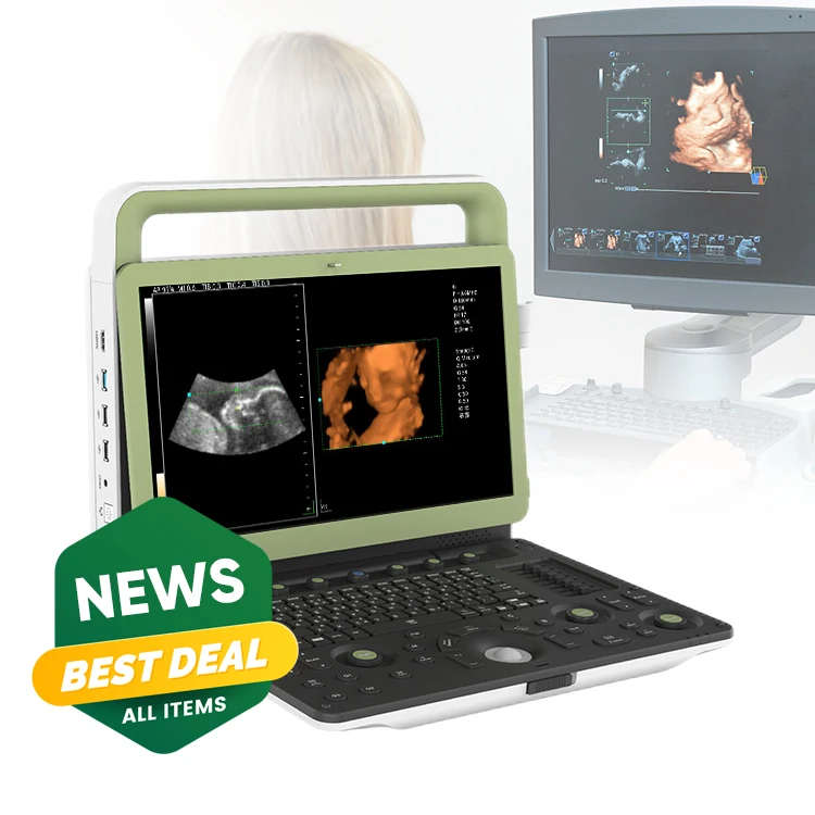 Medsinglong Linear Ultrasound Scanner Medical Ultrasound Instruments 4D 5D Portable Ultrasound Machine for Pregnancy