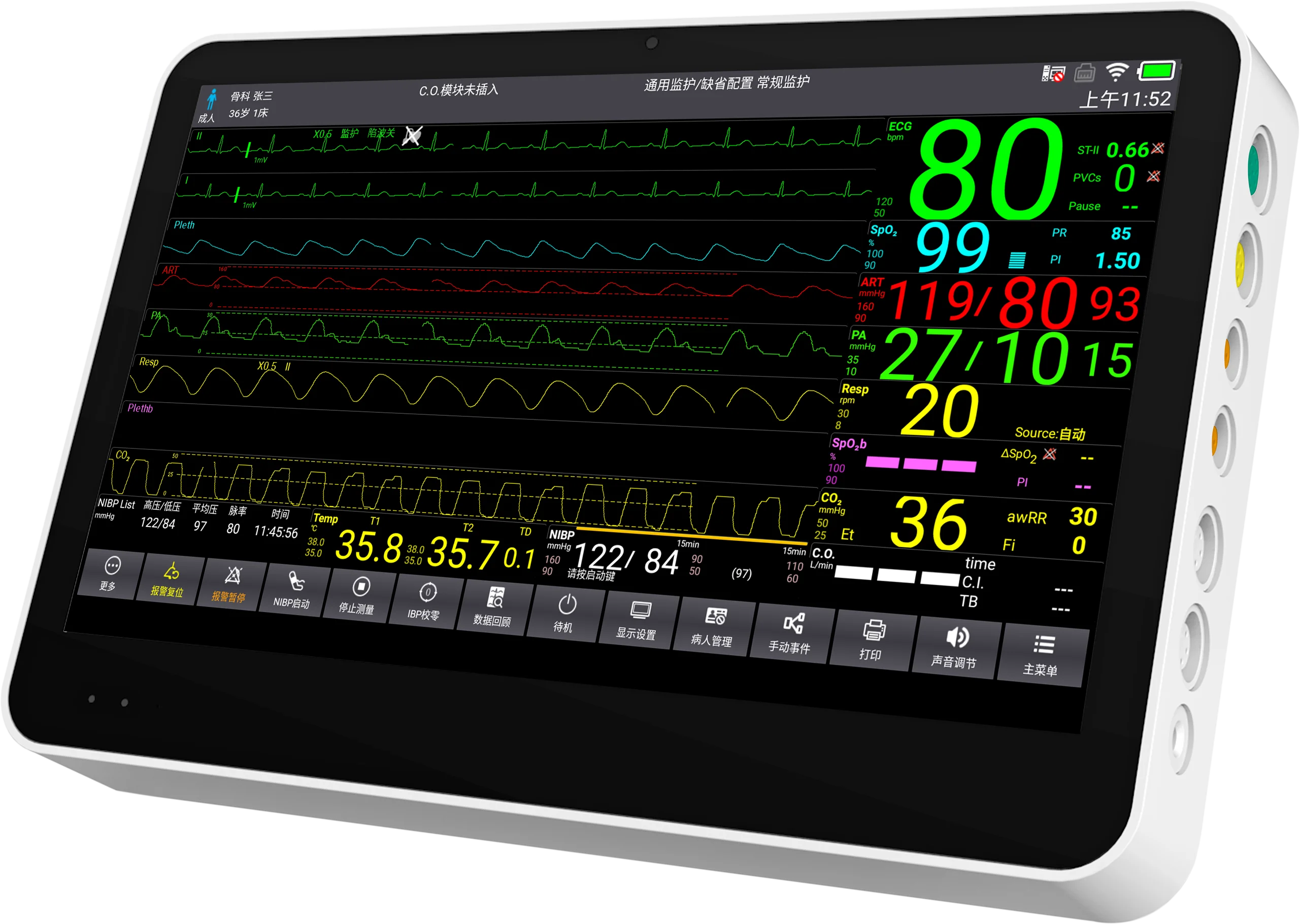 contec-cms8500-hospital-monitoring-machine-12-lead-ecg-patient-monitor