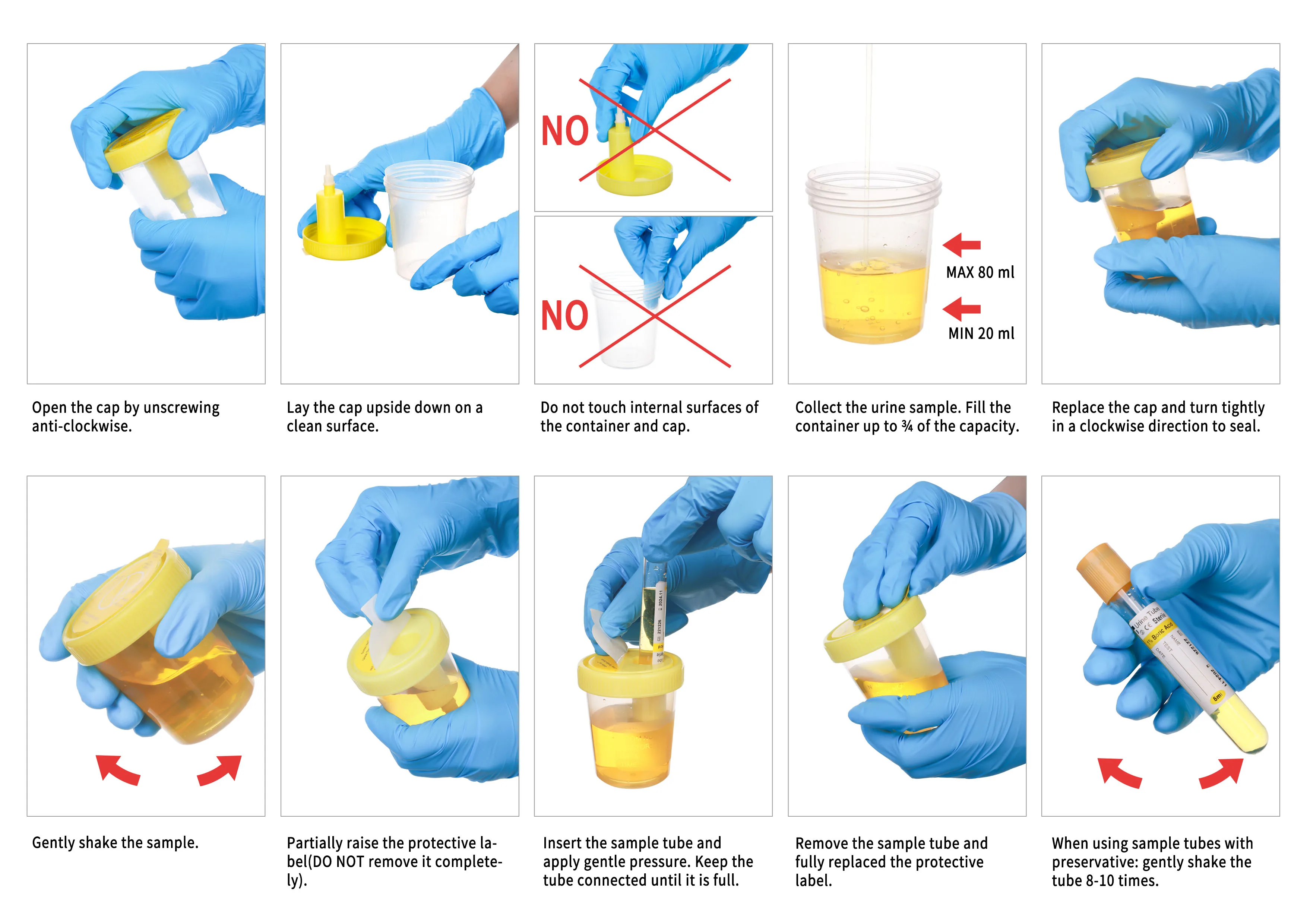 Sterile 120ml urine container with vacuum tube disposable medical urine cup factory