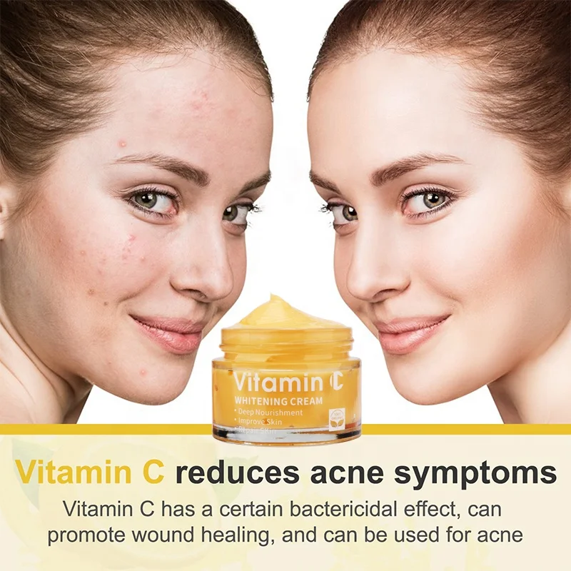 Private Label Organic Arbutin Vitamin C Anti Wrinkles Moisturizer Bleaching Whitening Black Spot Face Cream