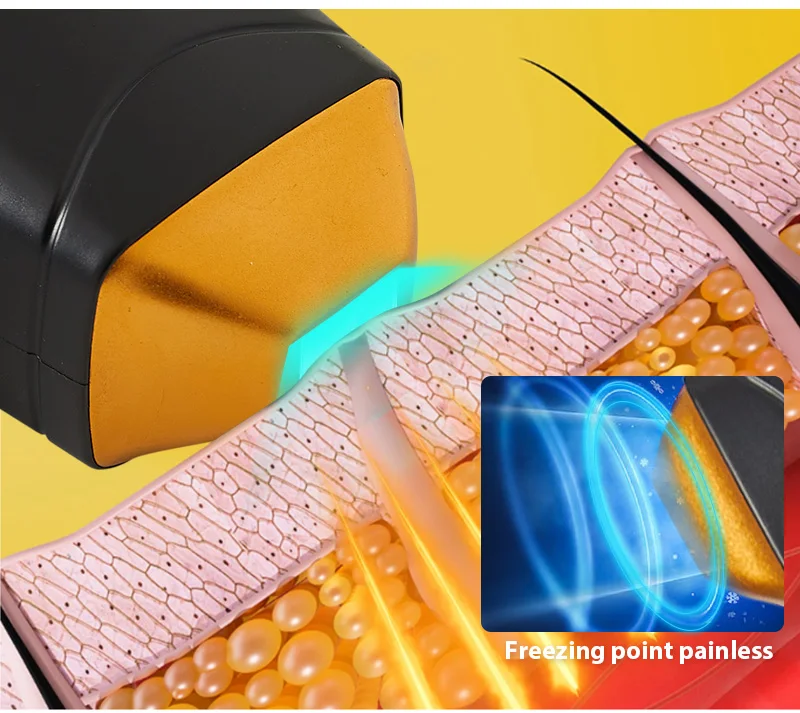 Good Diode Hair Removal Laser Diode Laser Beauty Machine Buy 3