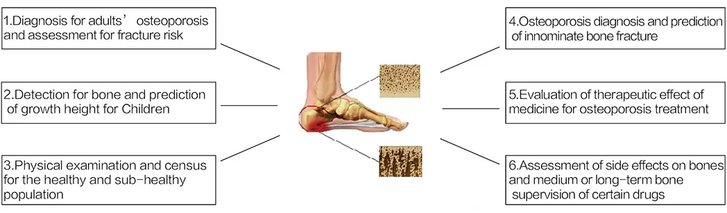 Highest Cost-effective HJ3000 Series Dexa Ultrasound Scan Bone Densitometer factory