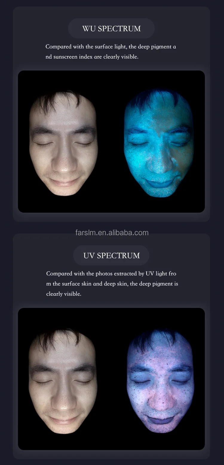 Digital Sebum Analysis