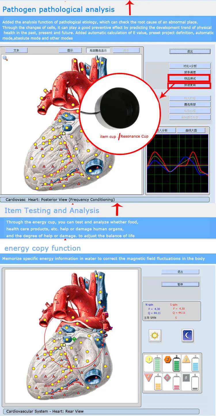 Portable USB DIZI A-200A 9D Detector NLSERA Health Management System 18D NLS Body Sub-health Organ Cell Cardiovascular Analyzer