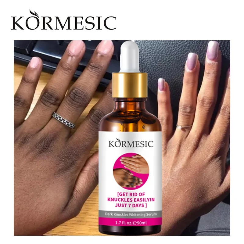 OEM KORMESIC Private Label Dark Knuckles Fast Whitening Serum Hand Knuckle Elbows Knee Intense Stains Remover Serum