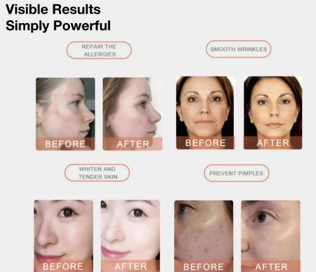 PDT LED Light Therapy Rejuvenating Skin Care / Pdt omega Led Light Therapy Machine with 7 Colors