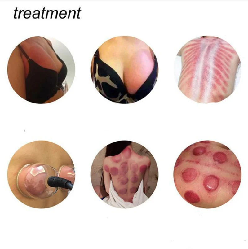 Anti Cellulite Vacuum Massage Cupping Fesse Therapy Equipment Ventosas Masajes Ventouse Electric Wholesale