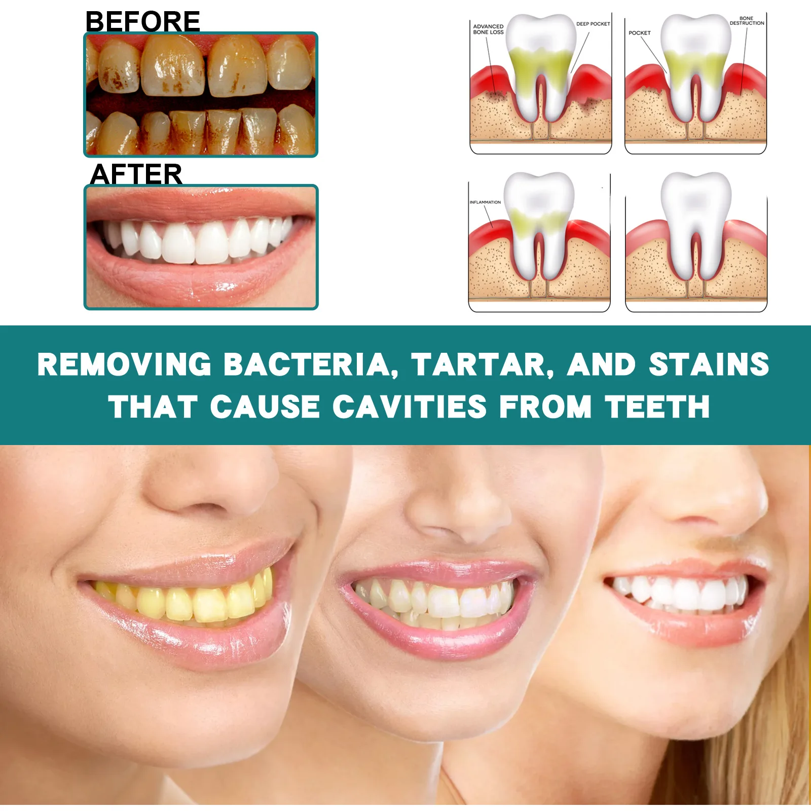 JAYSUING Teeth Colour Corrector Serum Stains Removal Anti Yellow