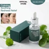 Suero calmante de centella