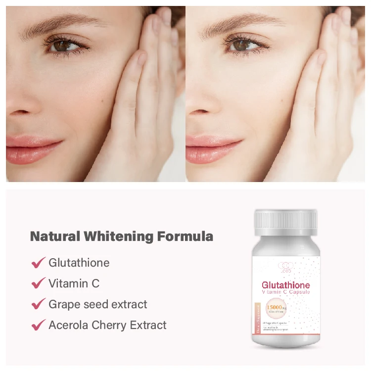 amazon glutathione skin whitening Renew Glutathione Skin Whitening Soap, 135G price in Saudi Arabia | Amazon  Saudi Arabia main image 0