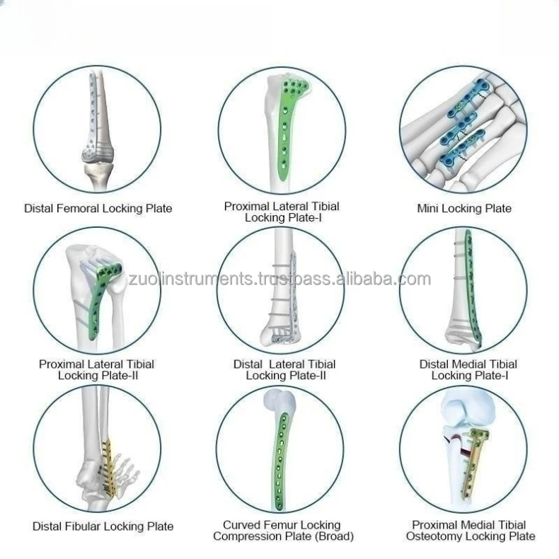 Surgical Condylar Blade Plate With Compression Holes orthopedic
