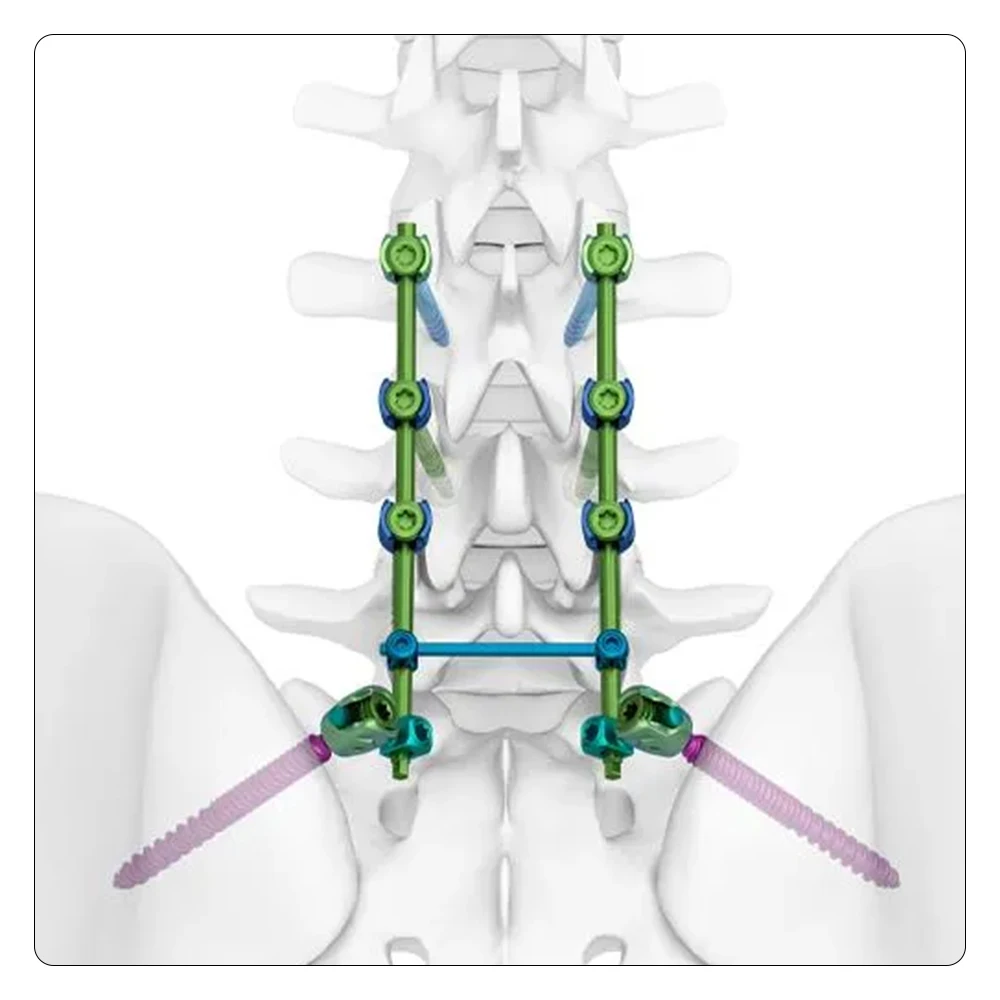 Spine