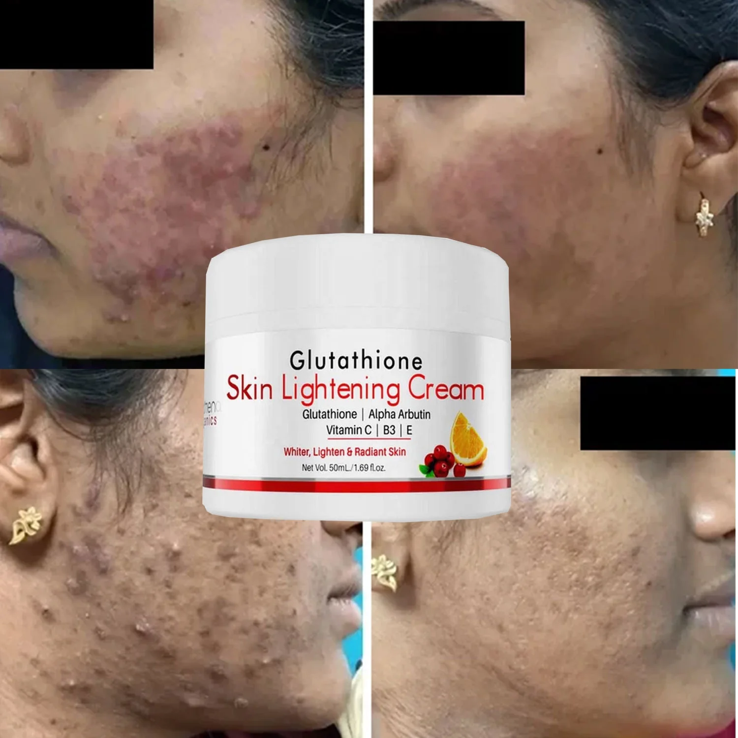 what is the maximum dose of glutathione What is the recommended dosage of glutathione (glutathione) for skin  brightening?