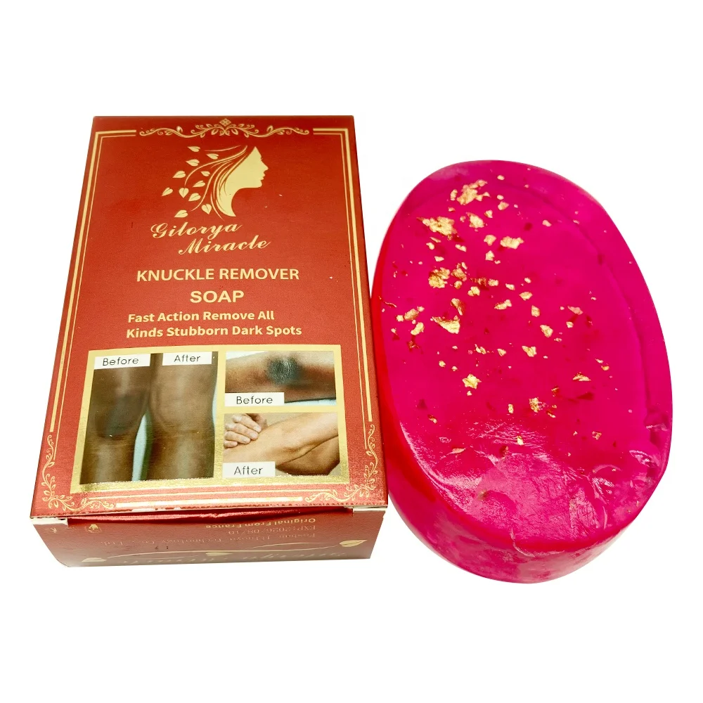 Fast Action Remove Stubborn Dark Spots Skincare Peeling Soap Lightens Melanin Whitening Nourish Skin Remove Dark Knuckle Soap