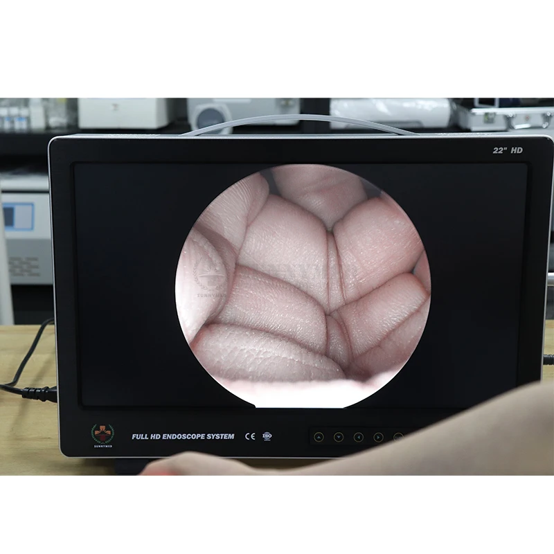 Высококачественная медицинская камера для эндоскопии с разрешением 4K