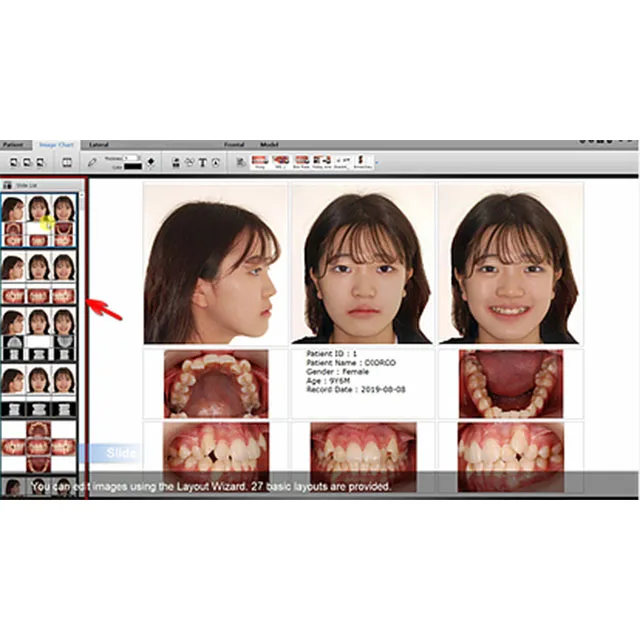 SmartCeph Korean Best Quality 2D cephalometric x-ray diagnosis
