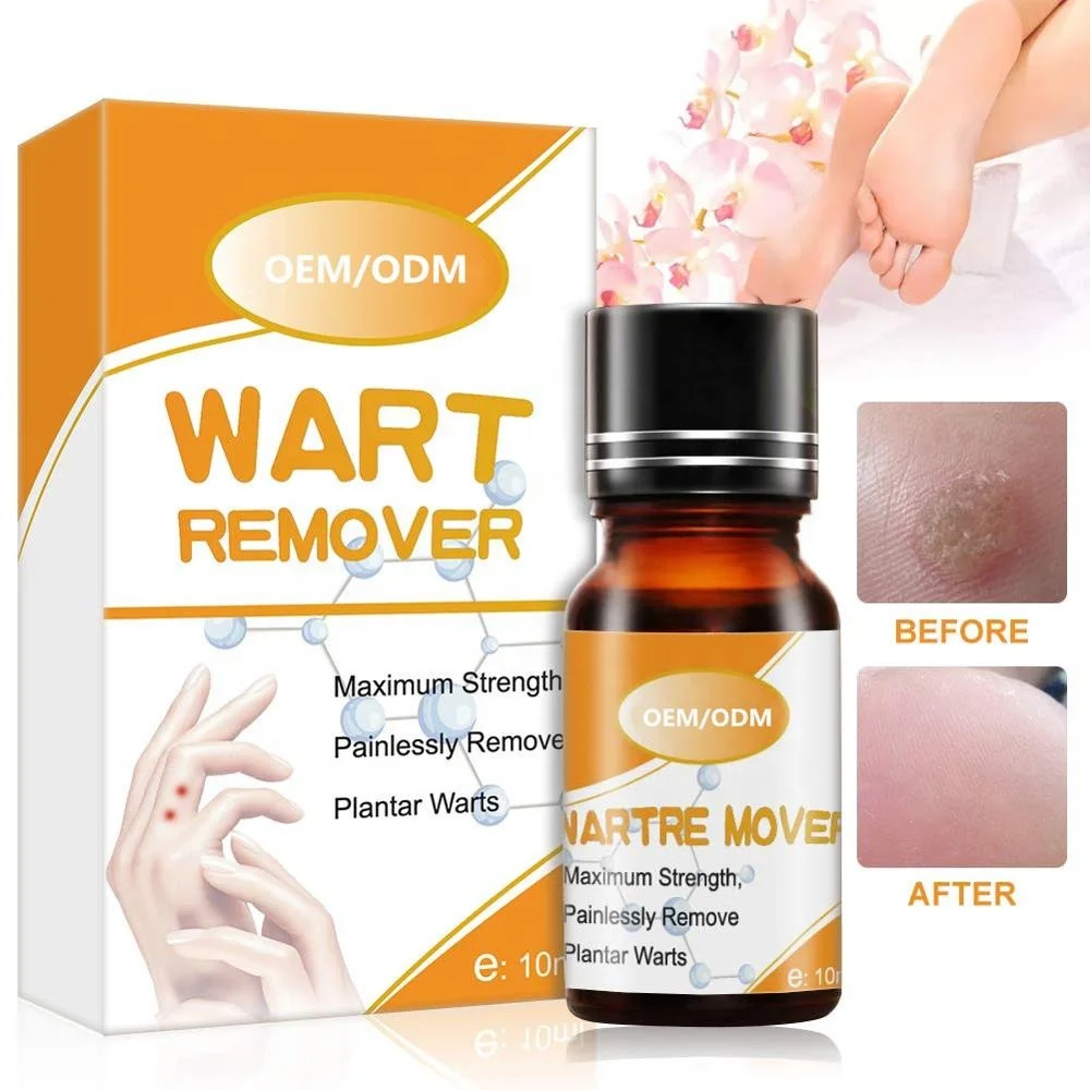 Wart перевод. Wart перевод. Wart removal ointment инструкция. Корейский крем wart removal ointment. Scholl wart removal system washproof.