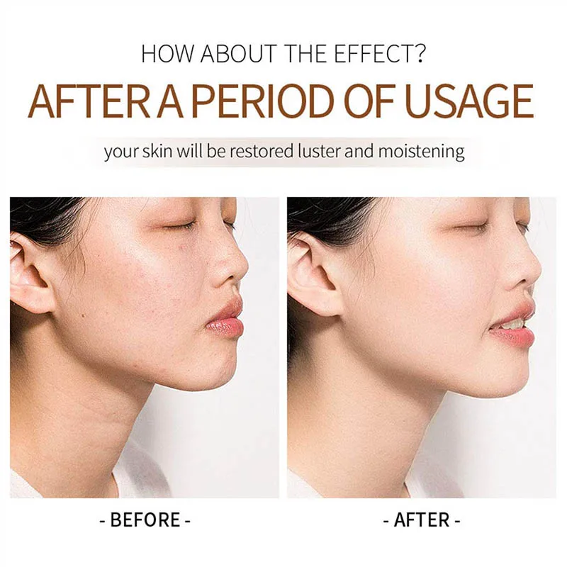 Pure Facial Repair Placenta Anti-wrinkle Anti- Wrinkles Face Body Eye With Vitamin E Oil Australian Australia Lanolin Cream
