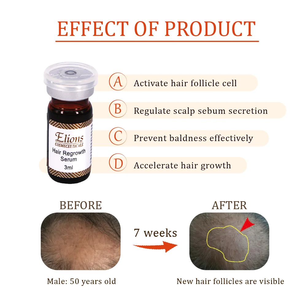 hair thickness enhancer