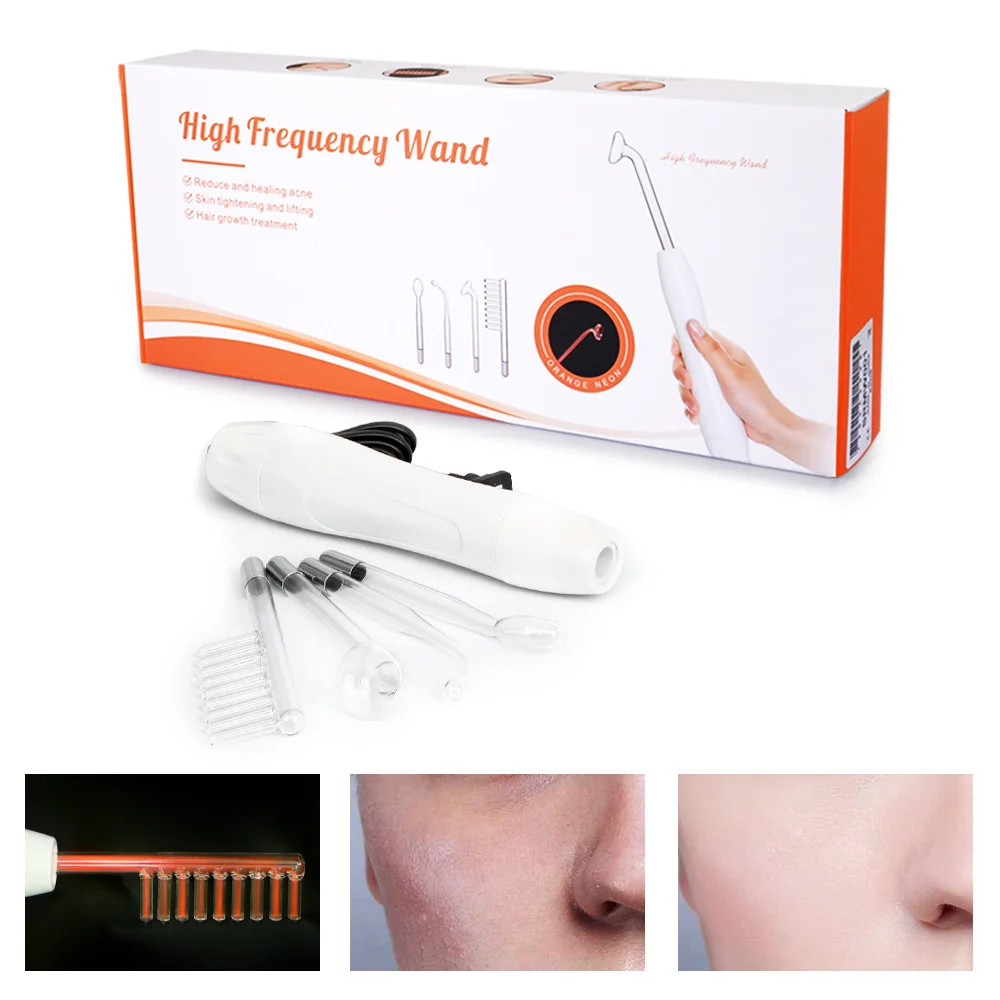 Высокочастотный аппарат для лица, высокочастотная терапевтическая палочка для ухода за лицом, другое домашнее косметическое оборудование