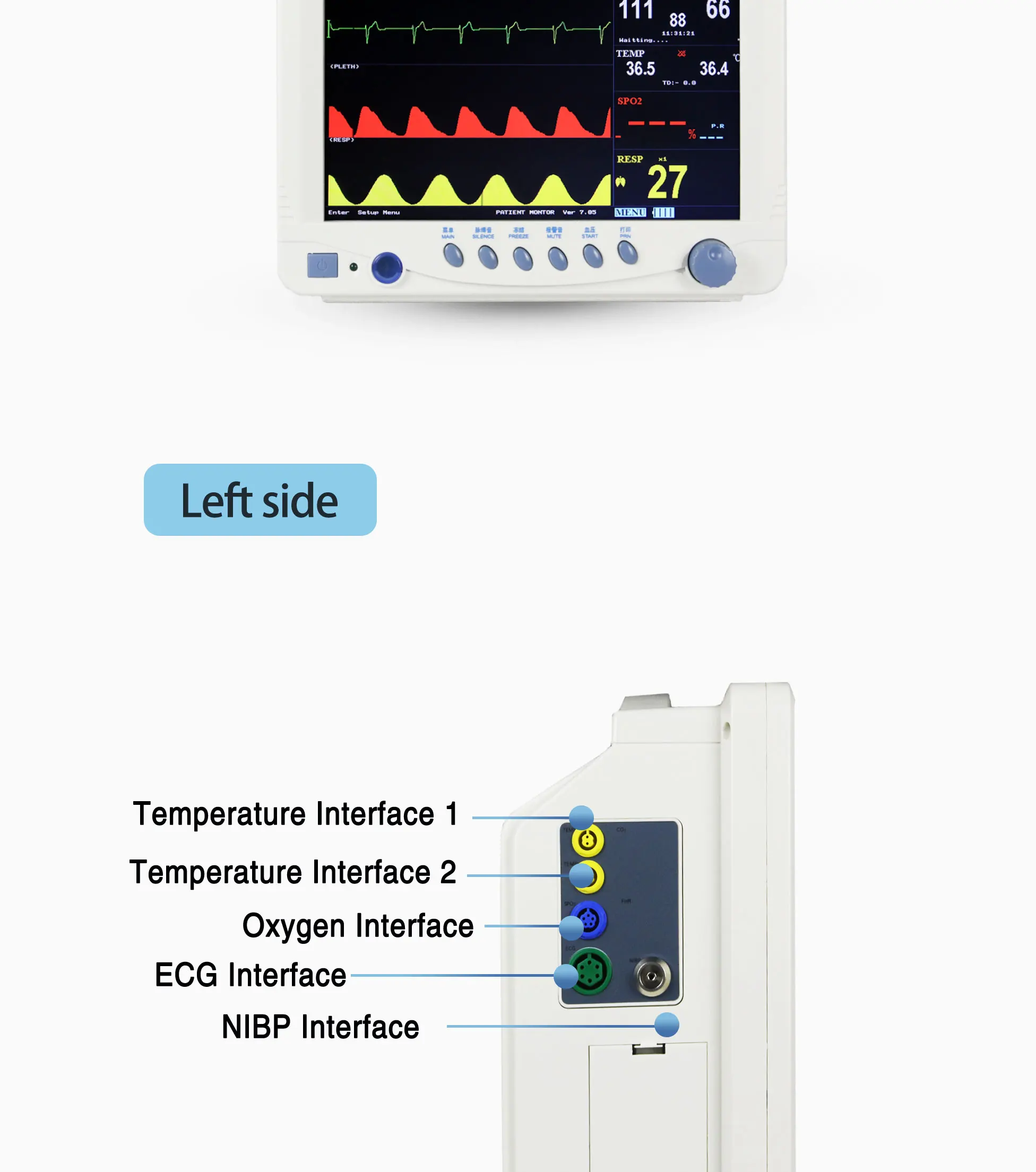 Patient Monitor with 1-7 Level Audio/Visual Alarming Arrhythmia Analysis and Anti-ESU Multi Parameter Bedside Monitor