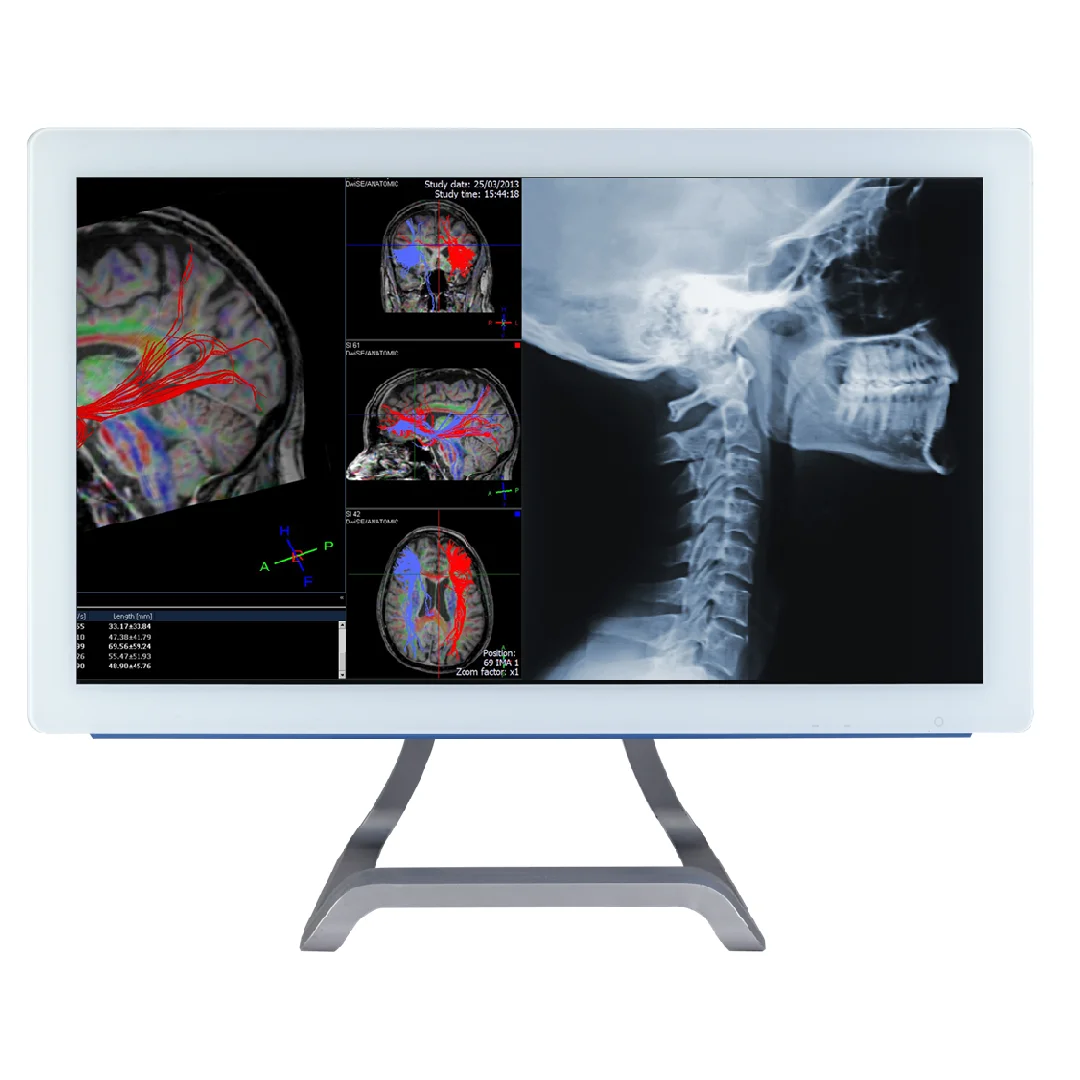 BriteMed 21″ Full HD 1080P High Resolution Medical Grade Video Loop-through Medical  Monitor