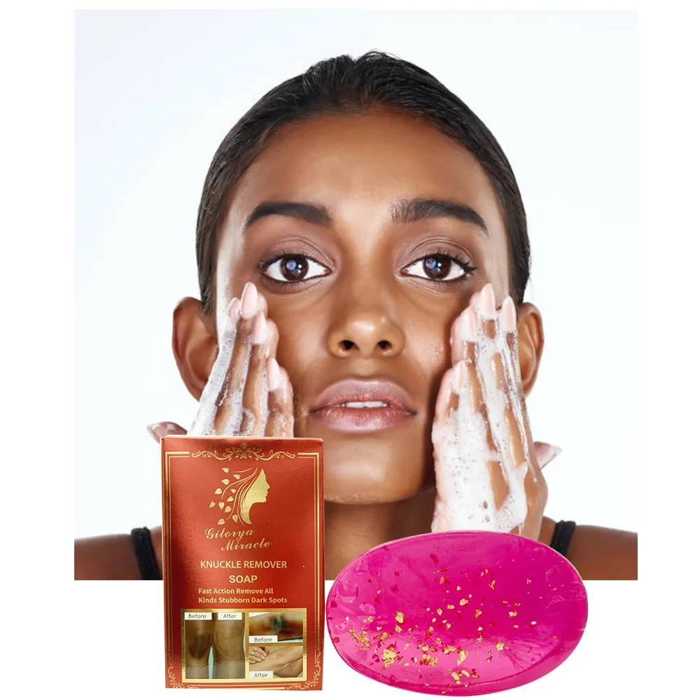 Fast Action Remove Stubborn Dark Spots Skincare Peeling Soap Lightens Melanin Whitening Nourish Skin Remove Dark Knuckle Soap
